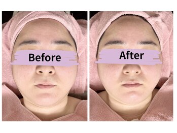 マリア(MALIA)/レッドショット正面変化