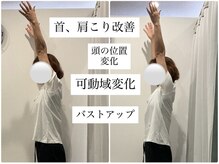 ユルル 刈谷店(Yururu)/変化(骨盤整体＆猫背整体)