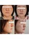 ホクラニ(Hokulani)の写真/二重あご・フェイスラインが気になる方に♪
すっきり小顔を目指す集中ケア