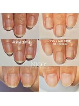 ニコプラス(NICO+)/