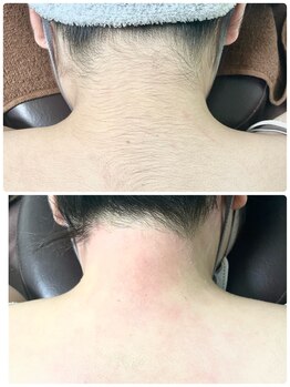 エン(en.)/BeforeAfter写真21