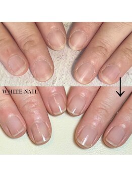 ホワイトネイル 武蔵小杉店(WHITE NAIL)/ネイルケア・自爪育成・爪育