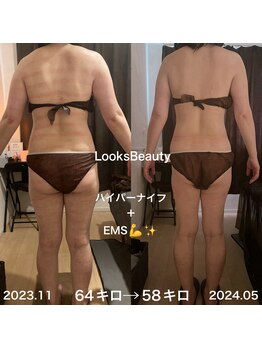 エステサロン ルックス ビューティー(エステサロン Looks Beauty)/プライベート空間