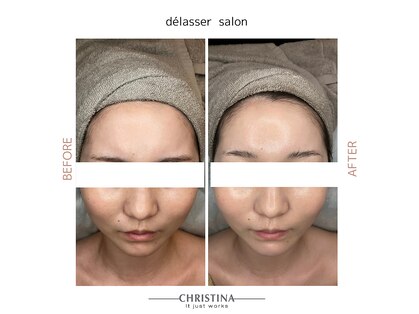 デラッセ(Delasser salon)の写真