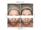 デラッセ(Delasser salon)の写真