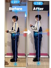 若松整体院/ビフォーアフター(3)