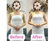 ボディキュア ブライダル美容整体 大阪梅田/最強のウエストに！/関西/大阪