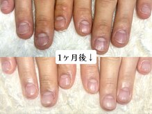 グラシナ なんば店/深爪/自爪育成/フィルイン