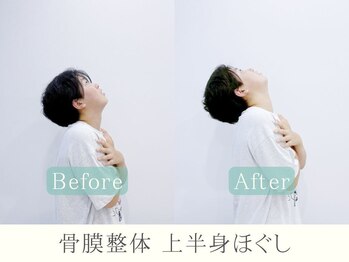 ヒラメント 藤沢(Hilament)/上半身の施術のビフォーアフター