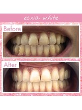 エクシアホワイト 倉吉店(ecxia white)/ビフォーアフター