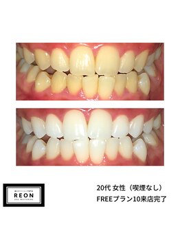 レオン 磐田(REON)/◇ お客様 before＆after ◇