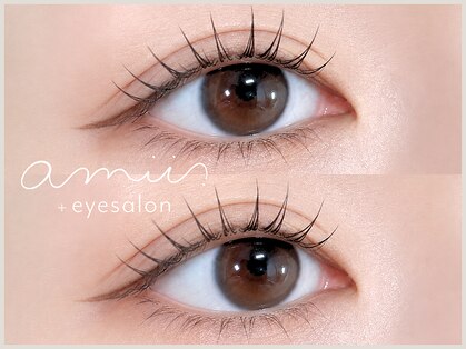 アミー 天神大名店(amii.)の写真