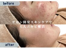 スハダビ110(suhadabi110)の雰囲気(メンバー登録で肌質改善ケアを特別価格にてご購入いただけます◎)