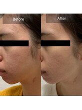 アールビューティ(R beauty)/VOSサロンケア