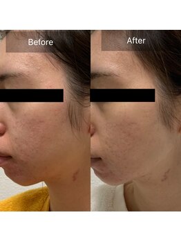 アールビューティ(R beauty)/VOSサロンケア