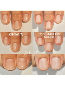 ニコプラス(NICO+)/