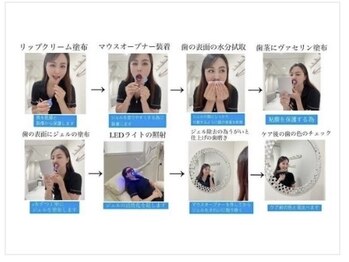 ホワイトニングショップ 柏店/施術の流れ