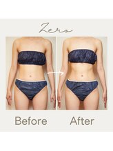 ゼロ シロカネ(ZERO SHIROKANE)/Before After
