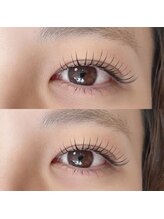 デイジー(DAY'S EYE)/エクパ　