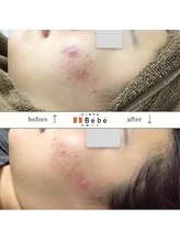 ベベ 大阪中央店(Be’be’)/