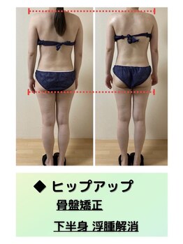 シャンタイン(SANTAI)/モンテセラピー★ヒップアップ