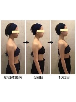 小顔フェイスラボ 袋井店(小顔FaceLabo.)/◆小顔&整体コルギで姿勢改善◆