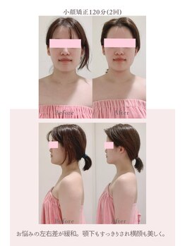 トゥインクル 麻布(twinkle)/港区/南麻布/白金/広尾/小顔矯正
