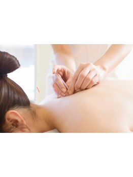 鍼灸施術を受けたい