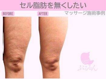 ぷるるんエステ/肩こり/リンパ/マッサージ/痩身