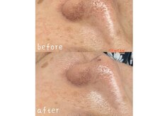 センガン(SENGAN)/キメ細やかで繊細なお肌に