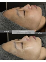 ケア(CARE)/クリスティーナ