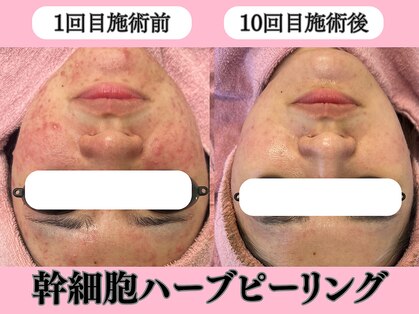 エンクリニカルラボ 京都駅前店(E&N CLINICAL LABO)の写真