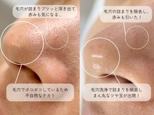 ミュー 名駅店(mieux)/【ハリ艶美白コース】