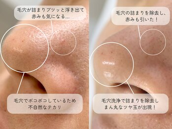 ミュー 名駅店(mieux)/【ハリ艶美白コース】