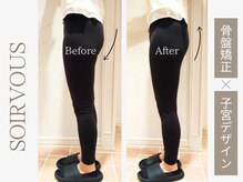 ソワーヴ(Soirvous)/美子宮骨盤彫刻術