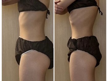 マイティー整骨院 ココア(CoCoa)/セルクラ