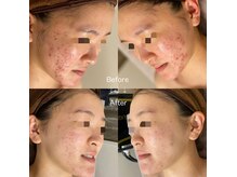 ハピネスビューティーサロン(happiness beauty salon)/