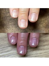 リリ(lili)/トータルハンドケア/ネイルケア