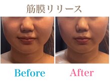 月香館の雰囲気（【圧倒的小顔・痩身】筋膜リリースで驚異の小顔！）