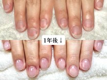 グラシナ なんば店/深爪/自爪育成/フィルイン