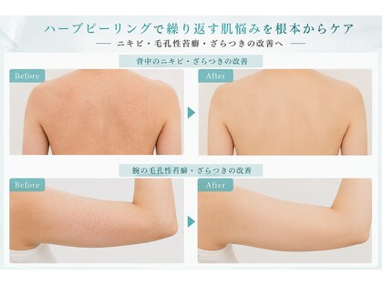 ルアナ 柏本店(LUANA)の写真