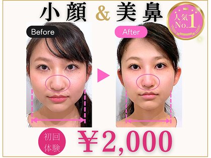 ラプリ 梅田店(Raplit)の写真