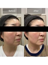 アールビューティ(R beauty)/