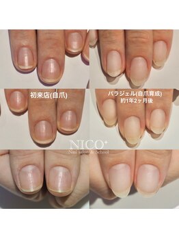 ニコプラス(NICO+)/