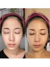 ミーティット(Meetite)/まつげ美容液ラッシュアディクト