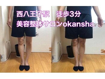 美容整体サロン オオカンシャ(okansha)/O脚Before→after