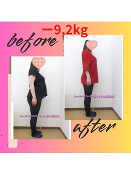 スーパースリムダイエット茅ヶ崎 茅ヶ崎整体院/3ヵ月－9,2ｋｇ減ダイエット♪