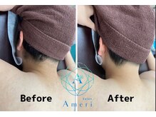 サロンアメリ イオンモール綾川店(Salon Ameri)/香川　うなじ脱毛　サロンアメリ