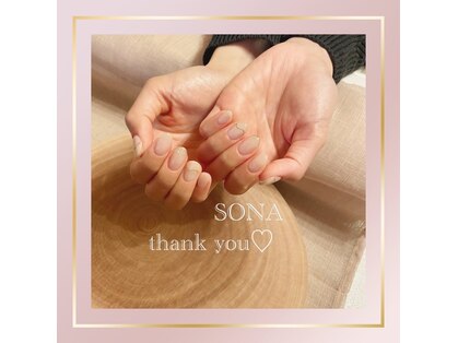 ソナ(Sona)の写真