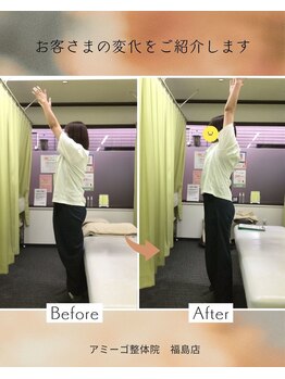 アミーゴ整体院/ビフォーアフター
